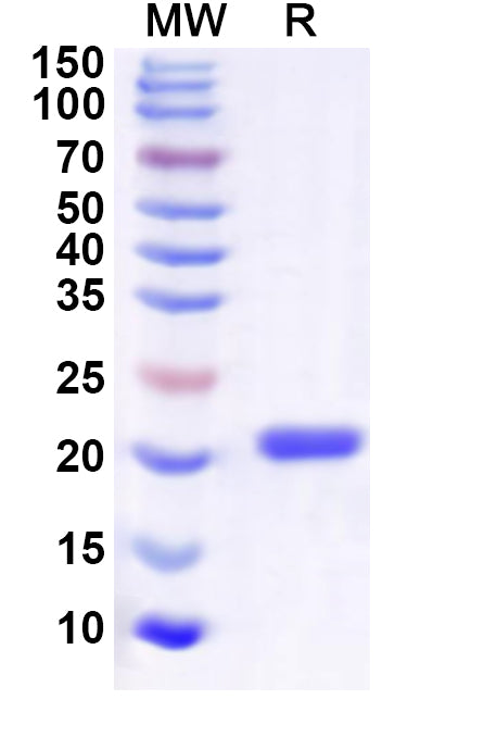 Recombinant Human POLR2F Protein, C-His