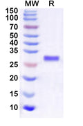Recombinant Human IGBP1 Protein, N-His