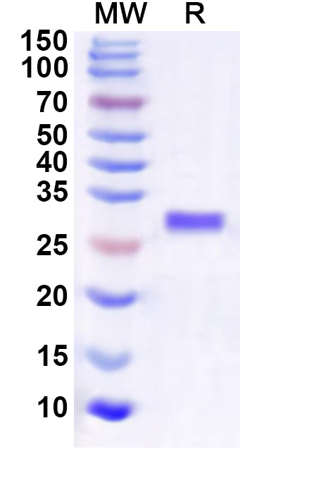 Recombinant Human IGBP1 Protein, N-His
