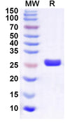 Recombinant Human ESRRG Protein, N-His