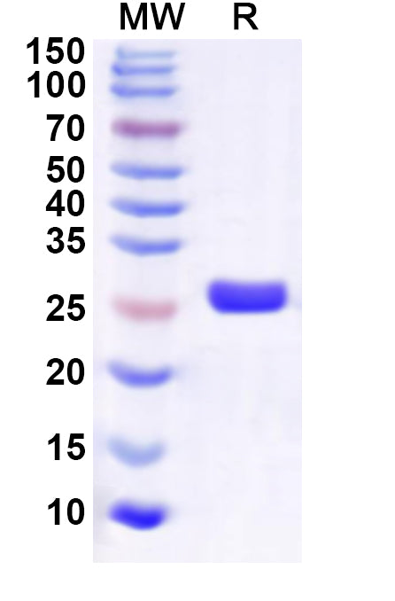 Recombinant Human ESRRG Protein, N-His