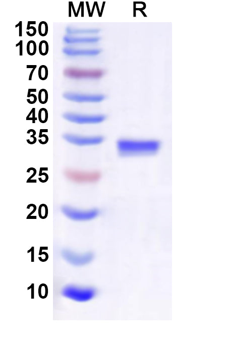 Recombinant Human RPS28 Protein, N-GST & C-His