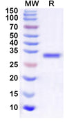 Recombinant Human RNF4 Protein, N-GST & C-His