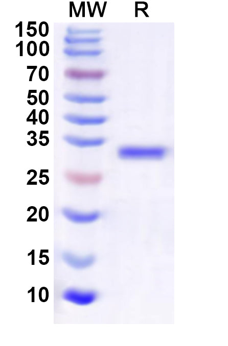 Recombinant Human RNF4 Protein, N-GST & C-His