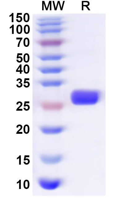 Recombinant Human PAFAH1B2 Protein, N-His