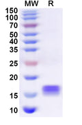 Recombinant Human TXNL4A Protein, N-His