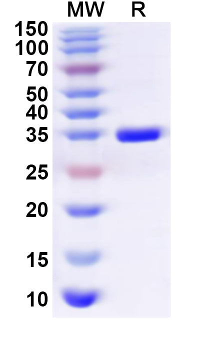 Recombinant Human SRSF3 Protein, N-GST & C-His
