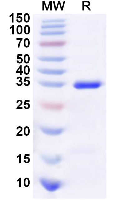 Recombinant Human HCLS1 Protein, N-GST & C-His