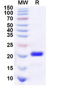 Recombinant Human SOX4 Protein, C-His