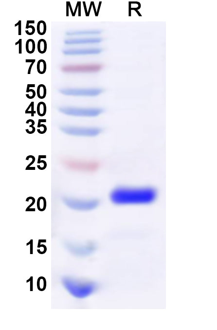 Recombinant Human SOX4 Protein, C-His
