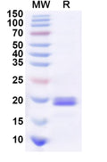 Recombinant Human COPZ1 Protein, N-His