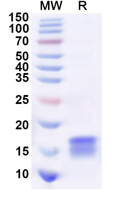 Recombinant Human CARD17P Protein, N-His