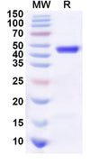 Recombinant Human APBA1 Protein, N-His