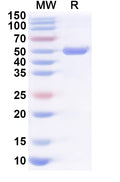 Recombinant Human KIF23 Protein, N-His