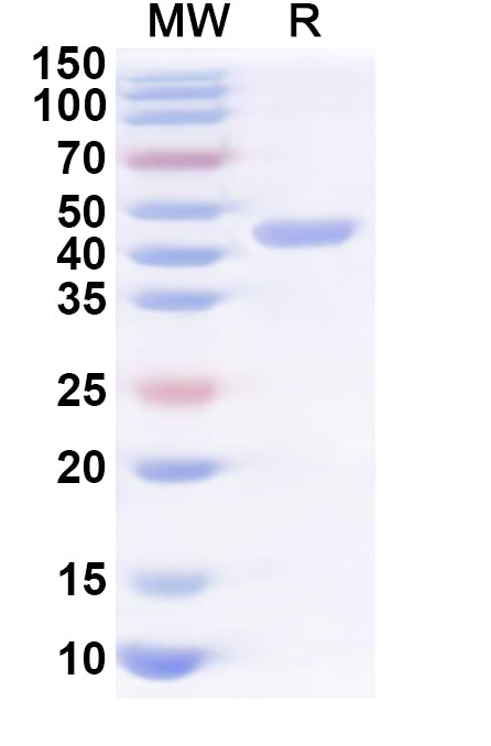 Recombinant Human MVK Protein, N-His