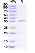 Recombinant Human H1-1 Protein, N-GST & C-His