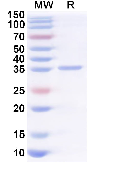 Recombinant Human H1-1 Protein, N-GST & C-His