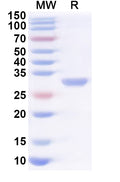 Recombinant Human KDSR Protein, N-His
