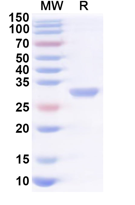Recombinant Human KDSR Protein, N-His