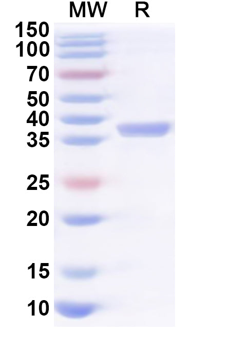 Recombinant Human REL Protein, N-His