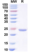 Recombinant Human HNRNPA0 Protein, N-His