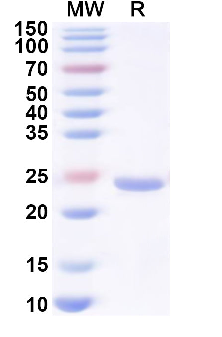 Recombinant Human HNRNPA0 Protein, N-His