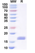 Recombinant Human LCP2 Protein, N-His