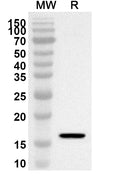 Western blot analysis was performed using anti-LCP2 polyclonal antibody at 1ug/mL on recombinant LCP2 (Catalog No. HB352012).