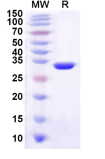 Recombinant Human MORN3 Protein, N-His