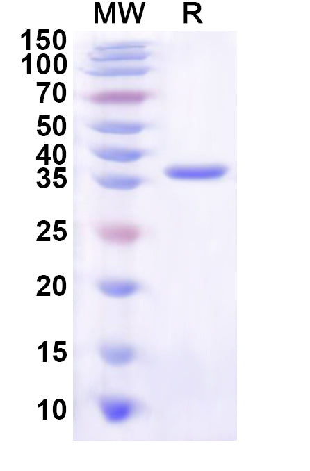 Recombinant Human WDR82 Protein, N-His
