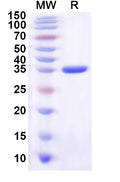 Recombinant Human ZDHHC24 Protein, N-GST & C-His