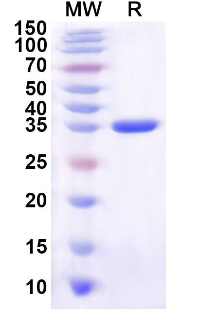 Recombinant Human ZDHHC24 Protein, N-GST & C-His