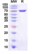 Recombinant Human PSRC1 Protein, N-His-KSI