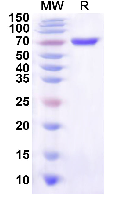Recombinant Human PSRC1 Protein, N-His-KSI