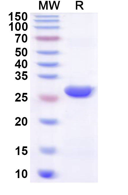 Recombinant Human SMARCD3 Protein, N-His