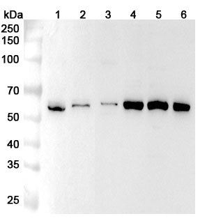 Western blot analysis was performed using anti-SMARCD3 polyclonal antibody at 1ug/mL on various samples.
Lane 1: BxPC-3 cell lysate
Lane 2: Hela cell lysate
Lane 3: U87 cell lysate
Lane 4: 293T cell lysate
Lane 5: K562 cell lysate
Lane 6: Jurkat cell lysate