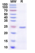 Recombinant Human ZNF783 Protein, N-His