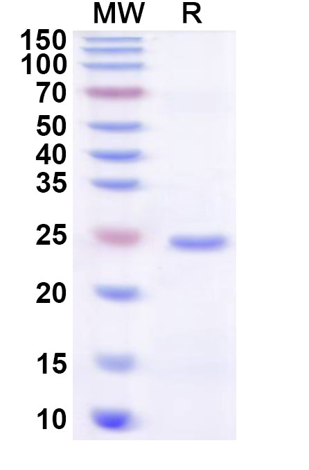 Recombinant Human ZNF783 Protein, N-His