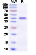 Recombinant Human ZFP2 Protein, N-His