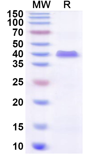 Recombinant Human ZFP2 Protein, N-His