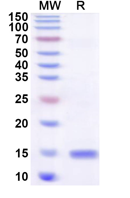 Recombinant Human BLOC1S2 Protein, N-His