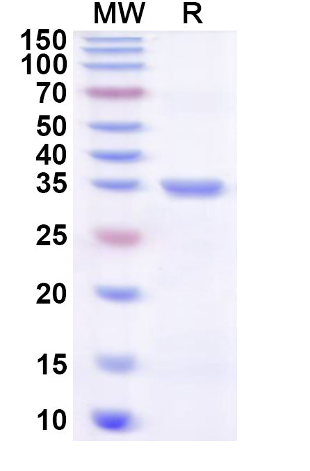 Recombinant Human GBP6 Protein, N-His