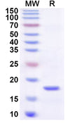 Recombinant Human ATF7IP Protein, N-His