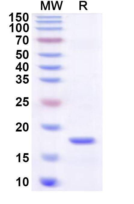 Recombinant Human ATF7IP Protein, N-His