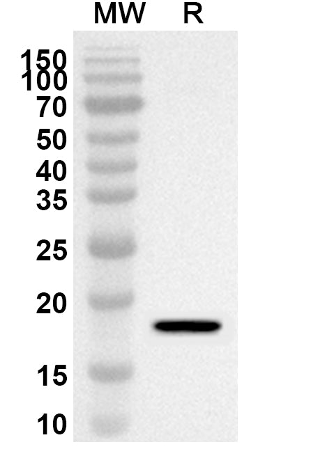 Western blot analysis was performed using anti-ATF7IP polyclonal antibody at 1ug/mL on recombinant ATF7IP (Catalog No. HB362012).