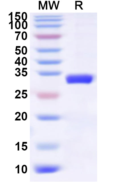 Recombinant Human TRIM40 Protein, N-His