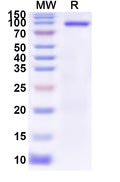 Recombinant Human PADI6 Protein, N-GST & C-His