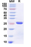 Recombinant Human ZCCHC12 Protein, N-His