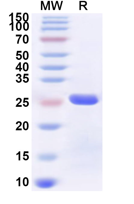 Recombinant Human ZCCHC12 Protein, N-His