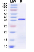 Recombinant Human ZNF774 Protein, N-His